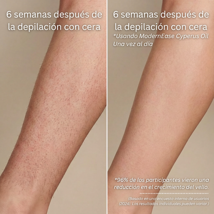 Aceite de Cyperus Valorie - Tratamiento para reducir el crecimiento del vello (60 ml)